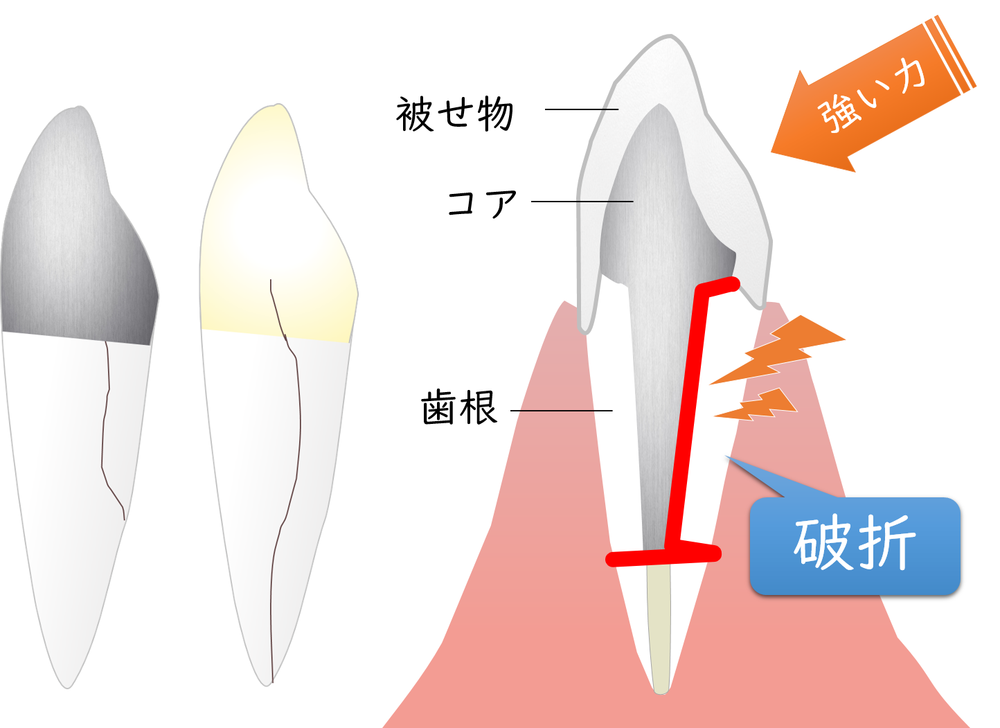 桶川（桶川市）の歯医者、のざき歯科の歯科用ＣＴ