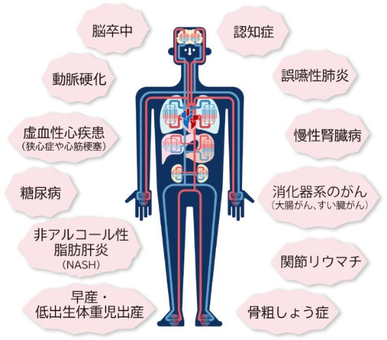 桶川（桶川市）の歯医者、のざき歯科の歯周病治療